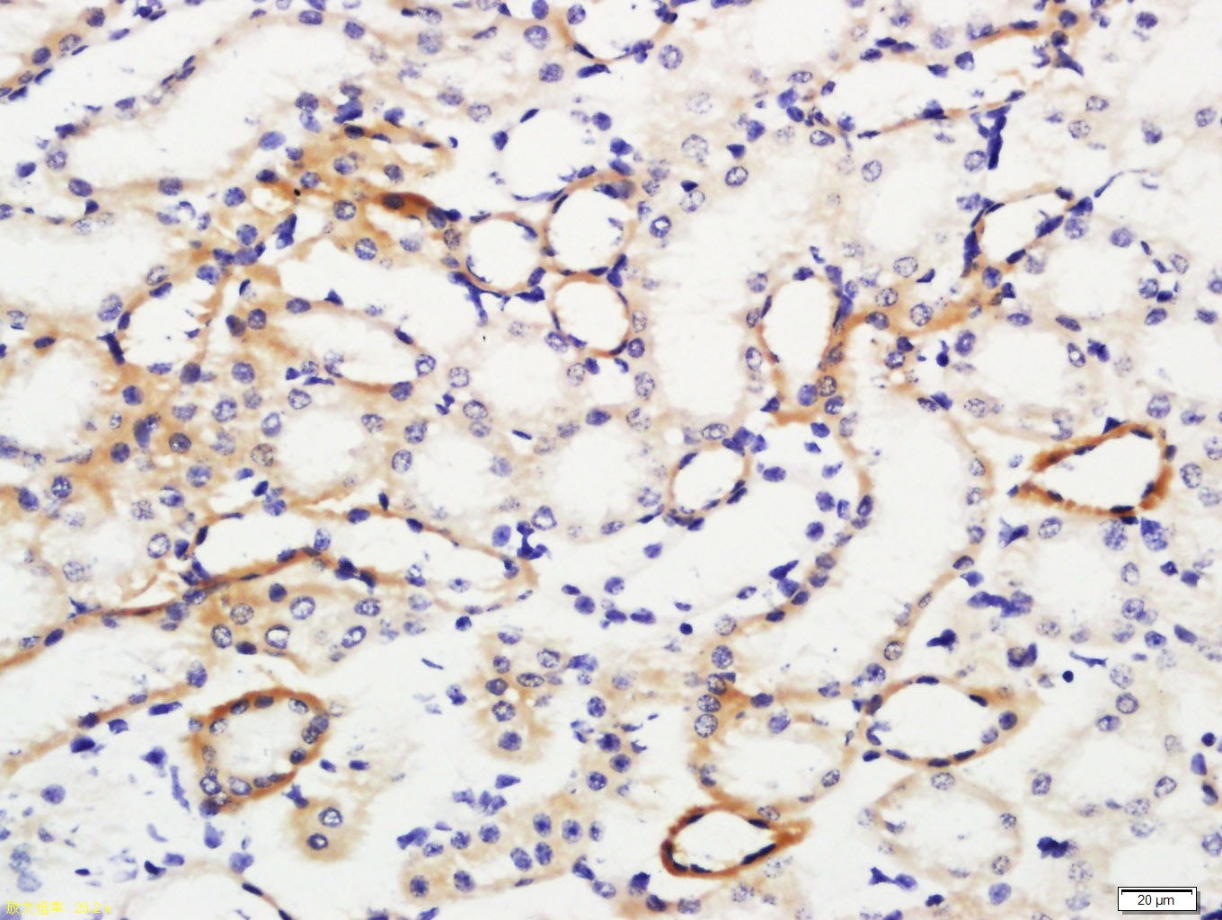 Anti-IL-10 Polyclonal Antibody