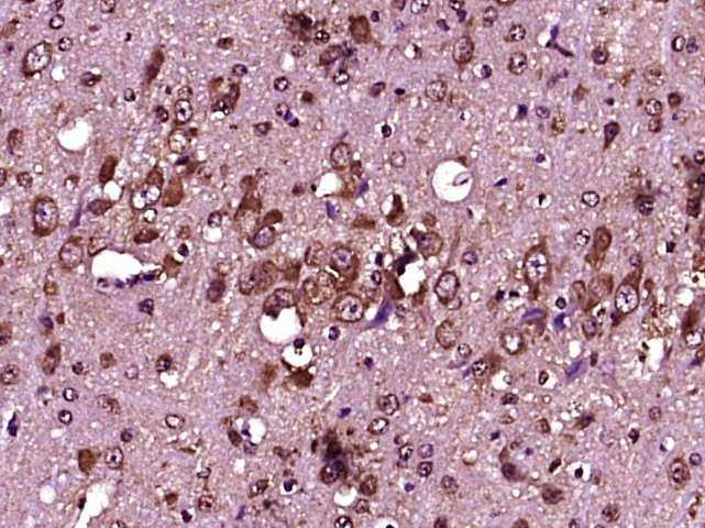 Anti-IL-12A Polyclonal Antibody