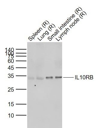Anti-IL-10R beta/IL-10RB Polyclonal Antibody
