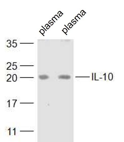 Anti-IL-10 Polyclonal Antibody 2