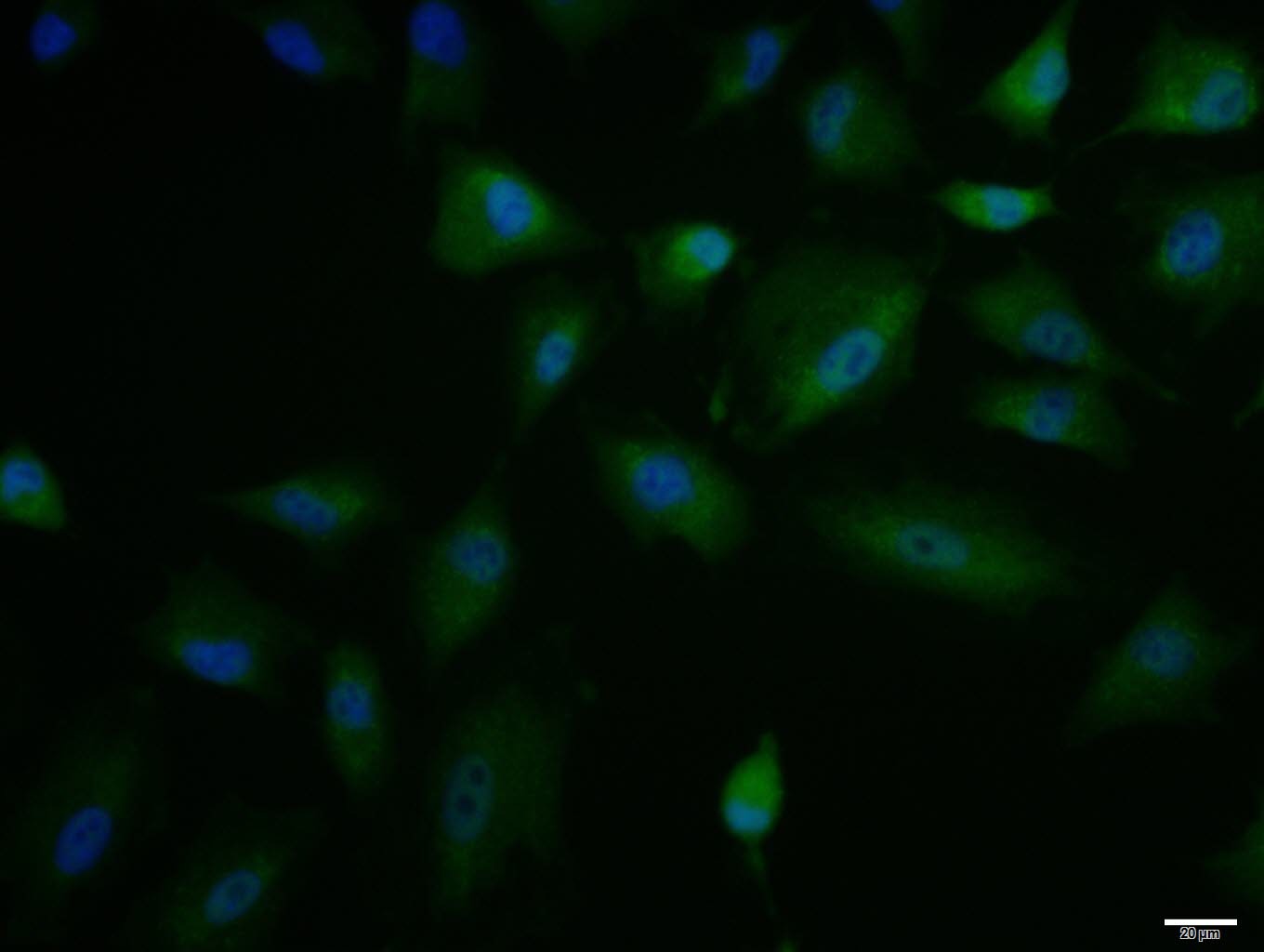 Anti-IL-15 Polyclonal Antibody