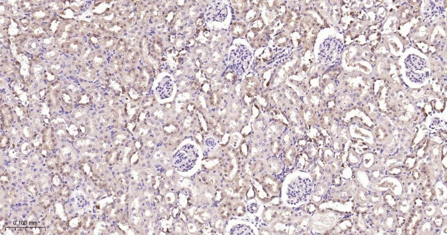 Anti-IKBKB Polyclonal Antibody