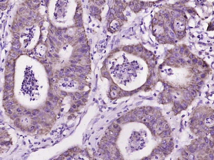 Anti-IL-17C Polyclonal Antibody