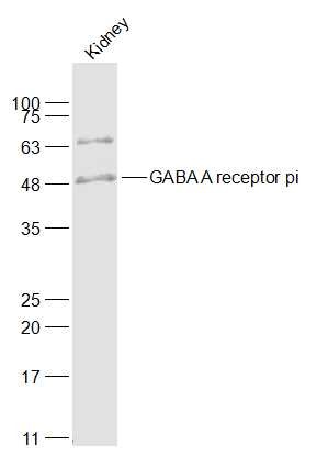 Anti-GABRP Polyclonal Antibody