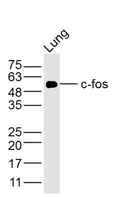 Anti-FOS Antibody (4X378)