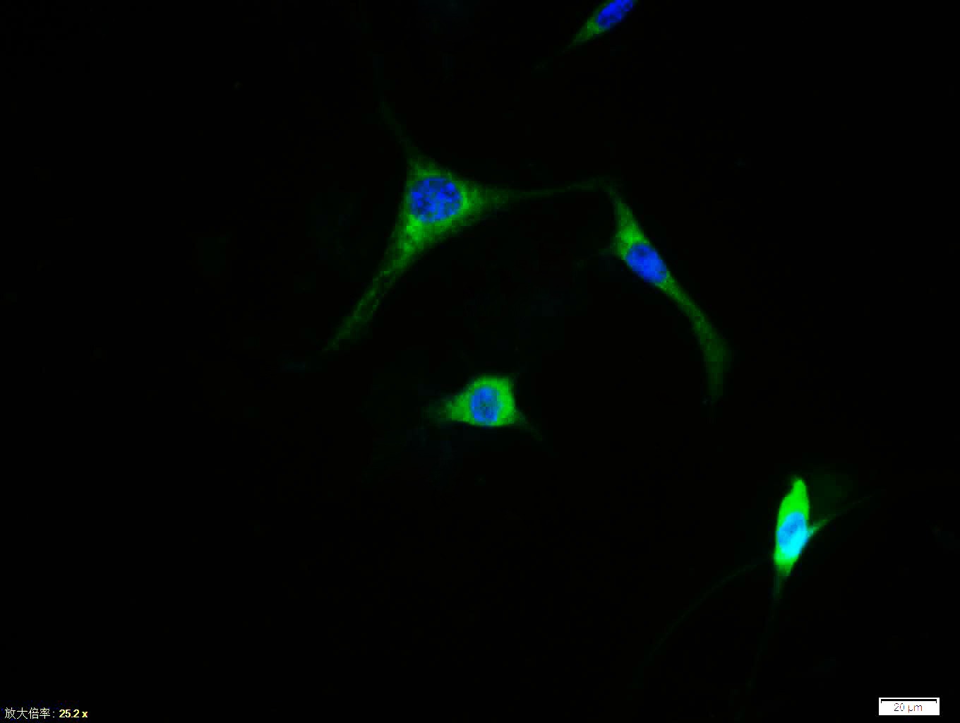 Anti-FOS Polyclonal Antibody
