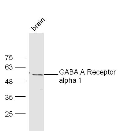 Anti-GABRA1 Polyclonal Antibody