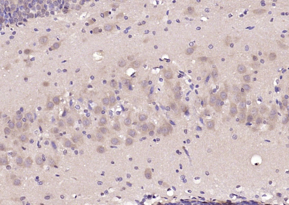 Anti-GABRA1 Polyclonal Antibody