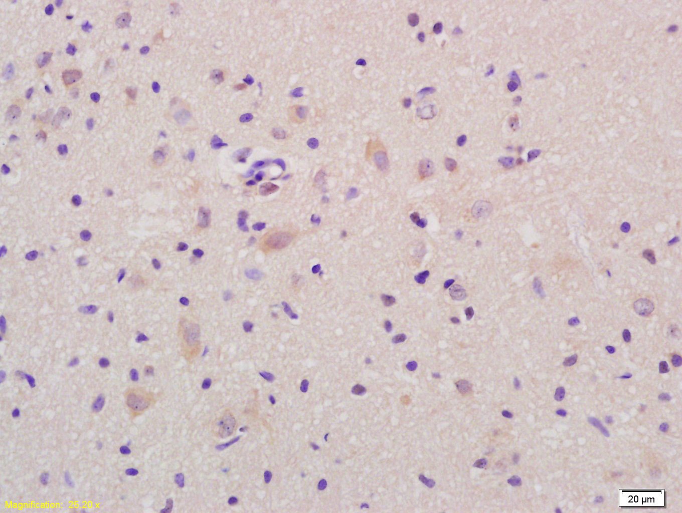 Anti-FOLR2 Polyclonal Antibody