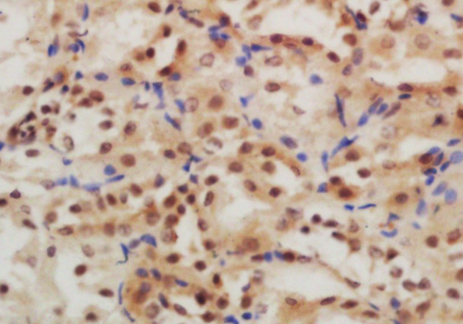 Anti-GLIS3 Polyclonal Antibody