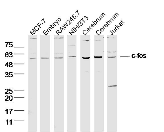 Anti-FOS Polyclonal Antibody