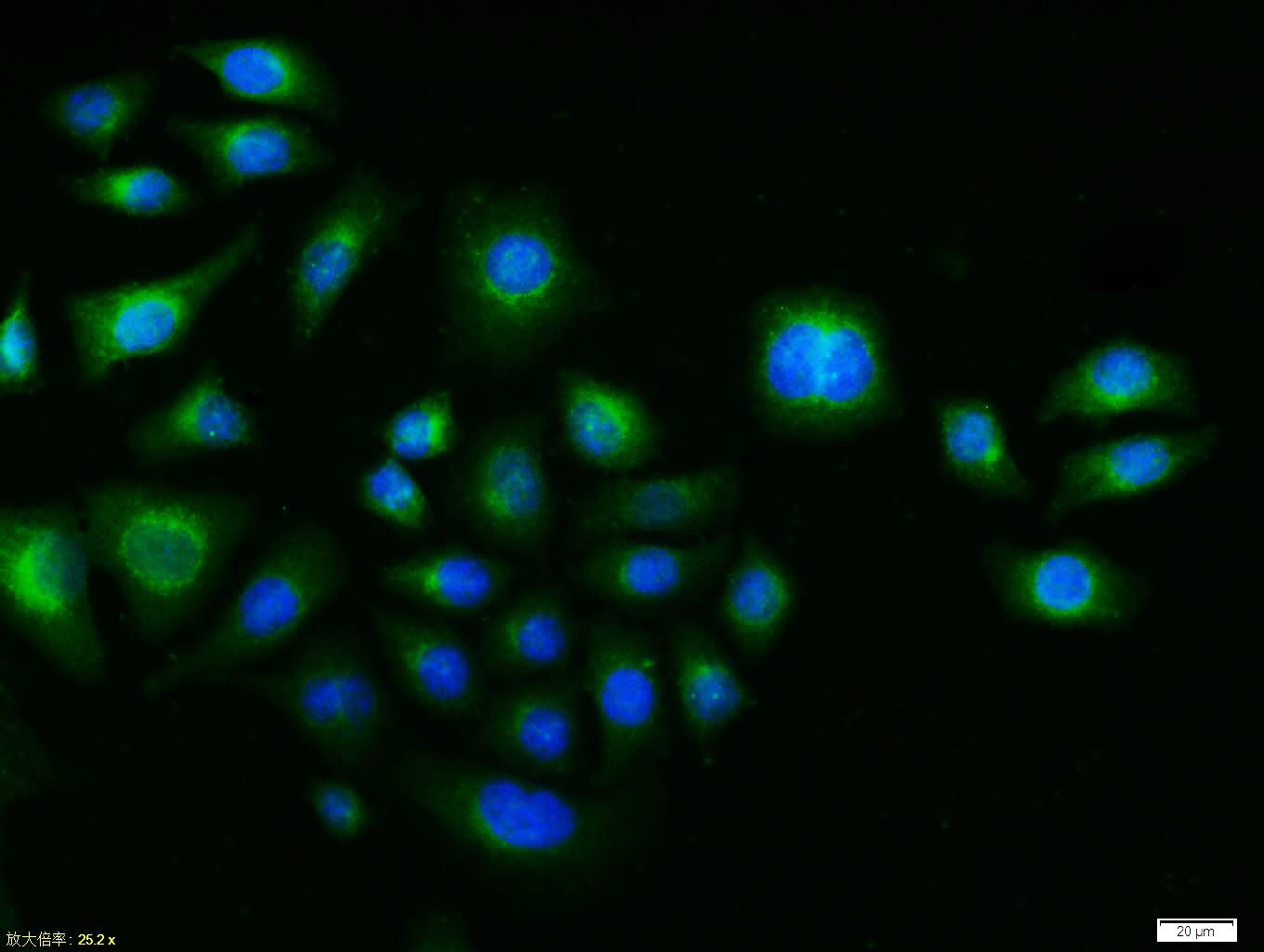 Anti-FOS Polyclonal Antibody