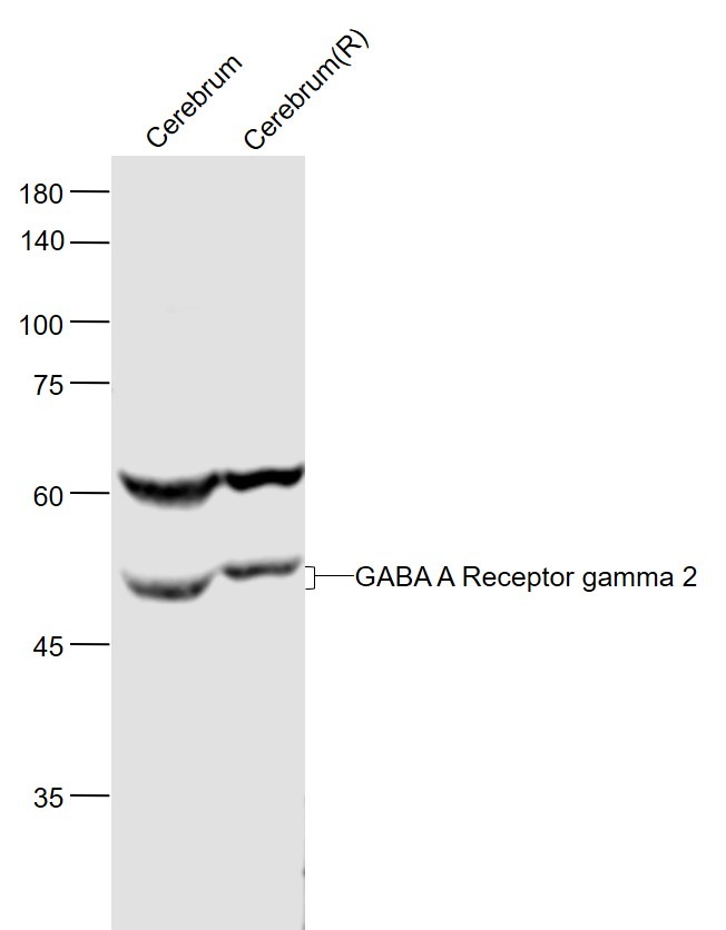 Anti-GABA A Receptor gamma 2 Polyclonal Antibody