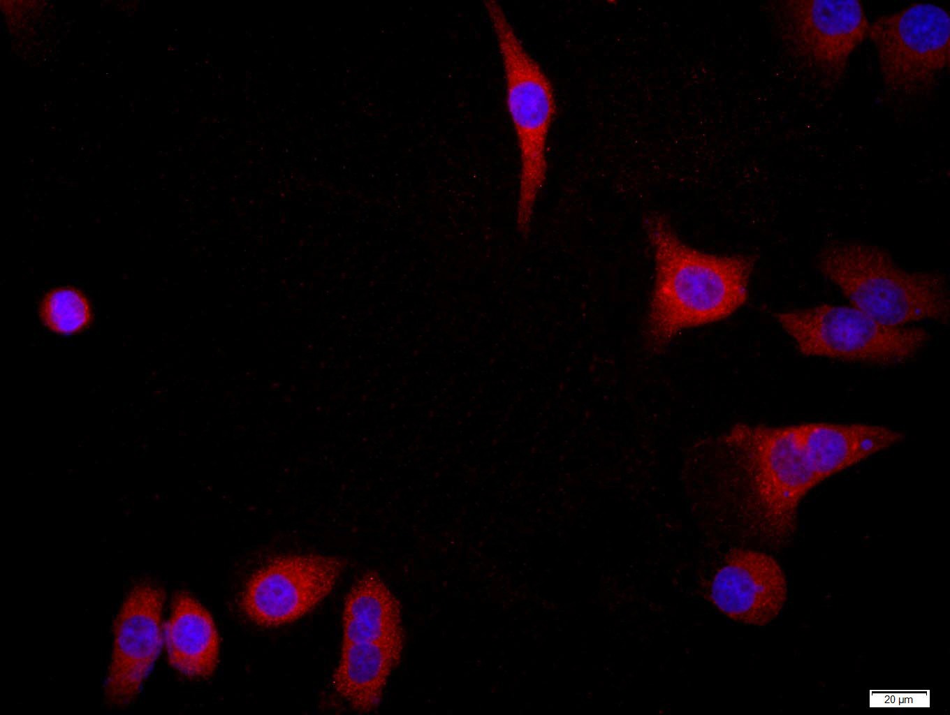 Anti-FGFR2 Polyclonal Antibody