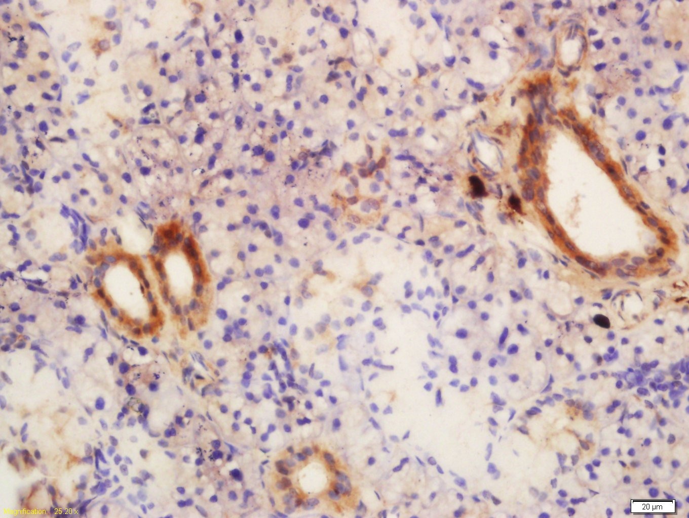 Anti-GLIS3 Polyclonal Antibody