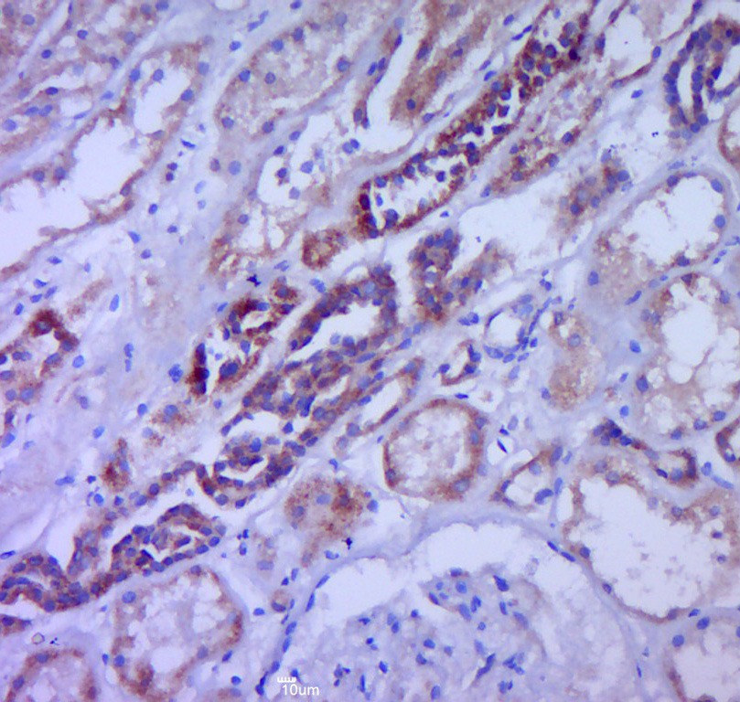 Anti-G-CSF Polyclonal Antibody