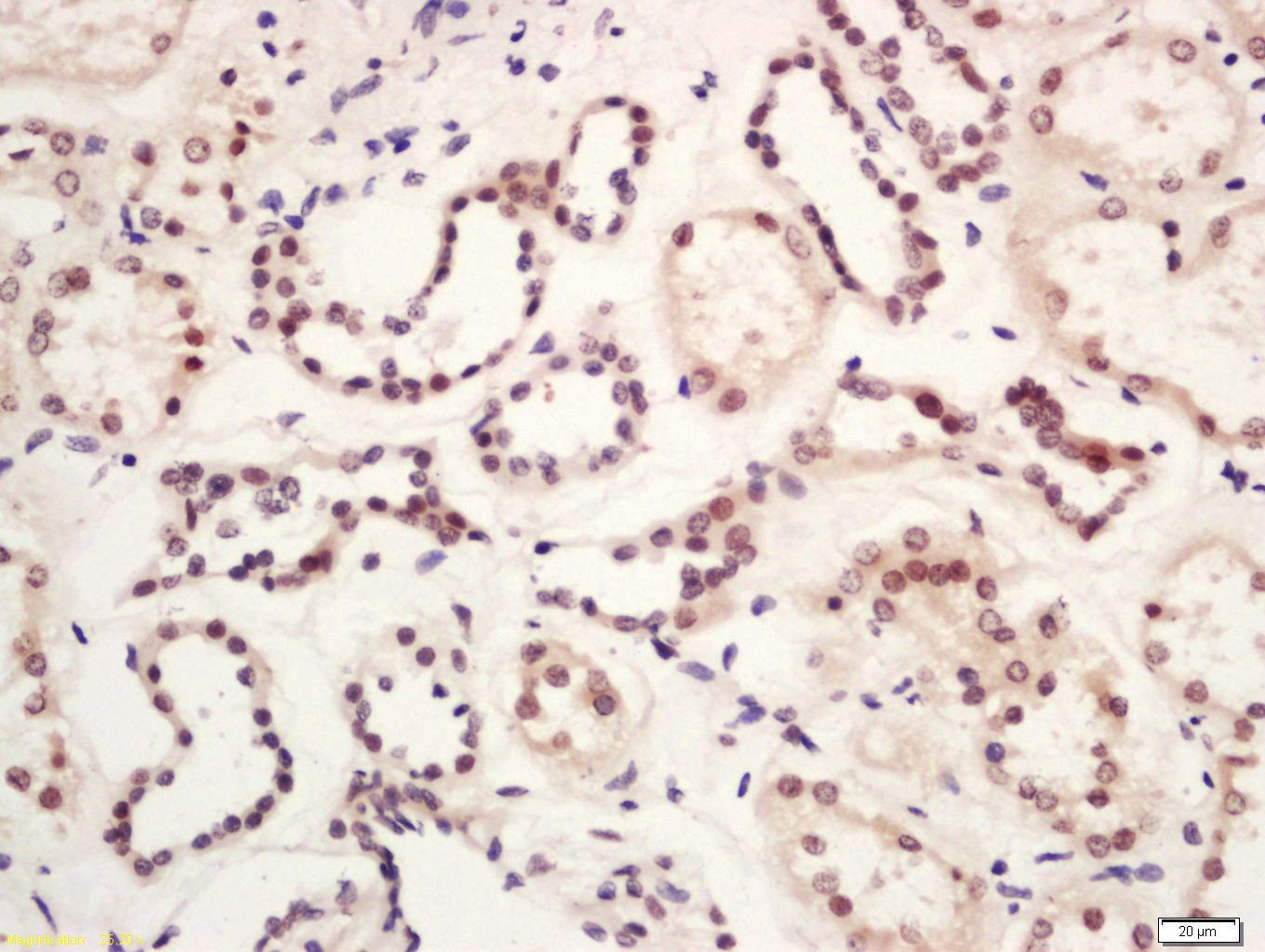 Anti-GLIS3 Polyclonal Antibody