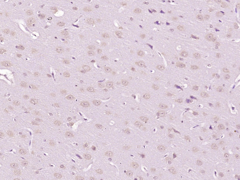 Anti-GDNF Polyclonal Antibody 2