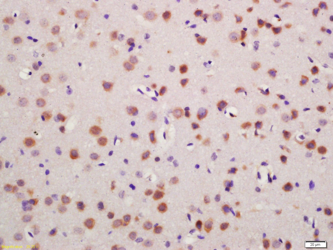 Anti-GLUL Polyclonal Antibody