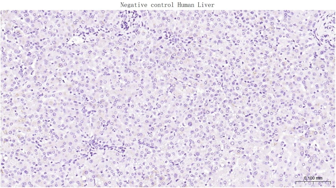 Anti-GLP1R Polyclonal Antibody