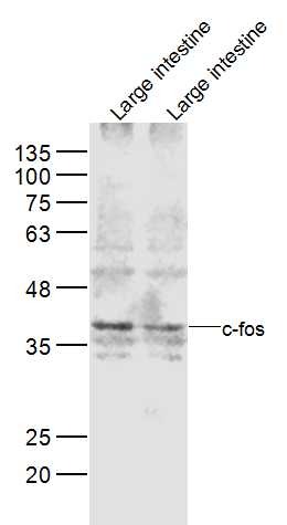 Anti-FOS Polyclonal Antibody 3