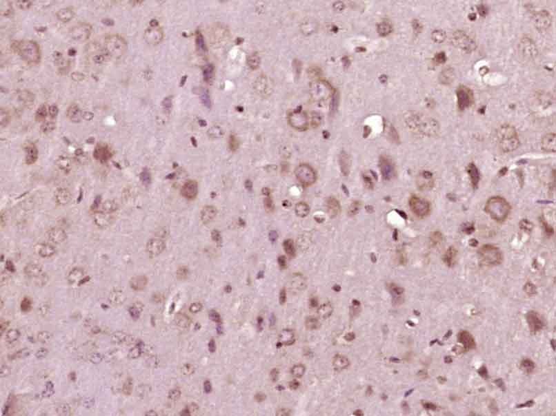 Anti-FGFR1 Polyclonal Antibody