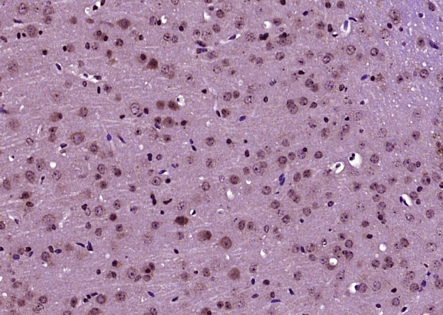 Anti-GLS1 Polyclonal Antibody