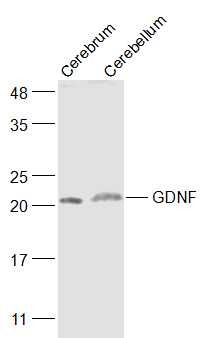 Anti-GDNF Polyclonal Antibody 2