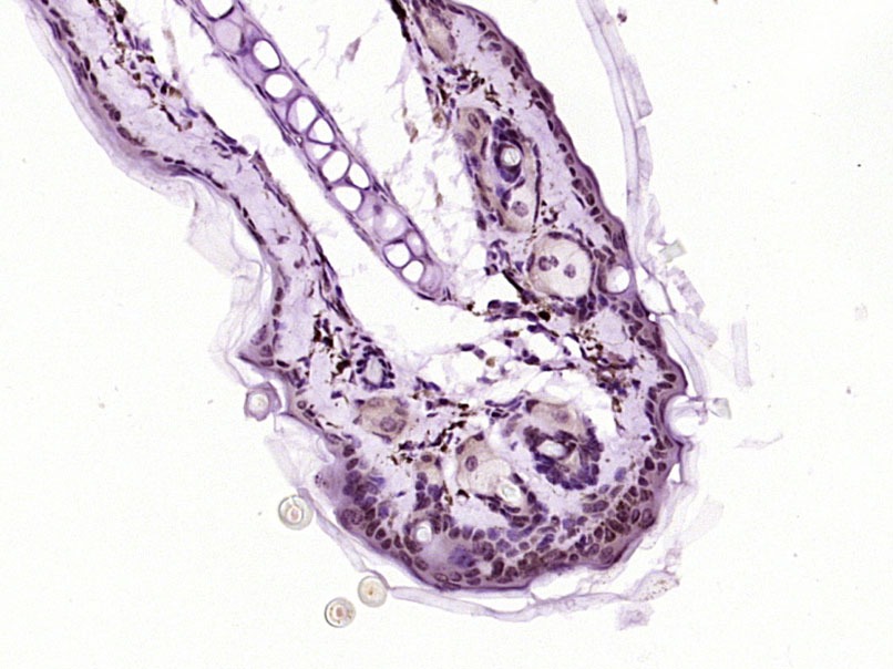 Anti-FOXN1 Polyclonal Antibody