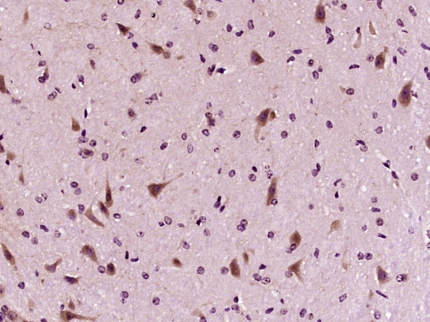 Anti-GDNF Polyclonal Antibody
