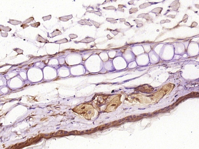 Anti-FOSL1 Polyclonal Antibody