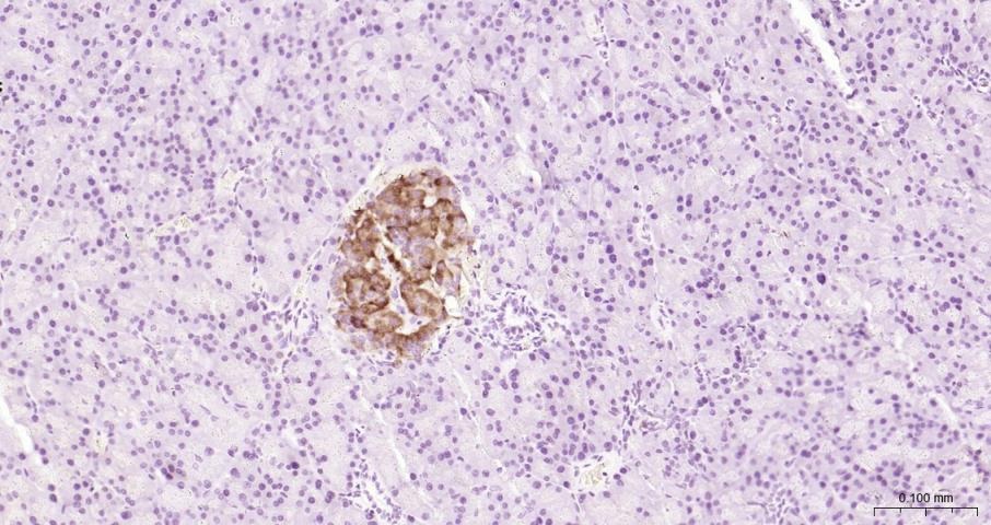 Anti-GLP1R Polyclonal Antibody