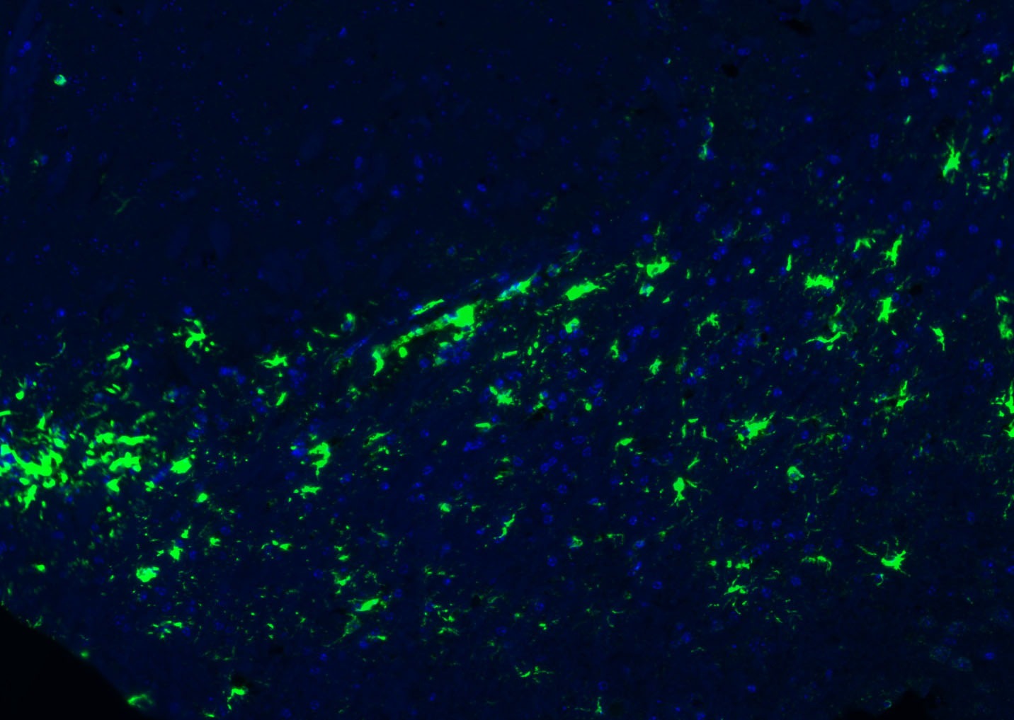 Anti-GFAP Polyclonal Antibody