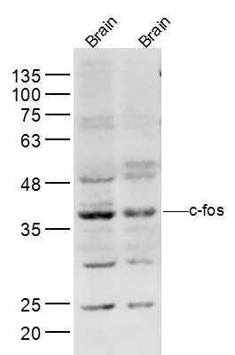 Anti-FOS Polyclonal Antibody 3
