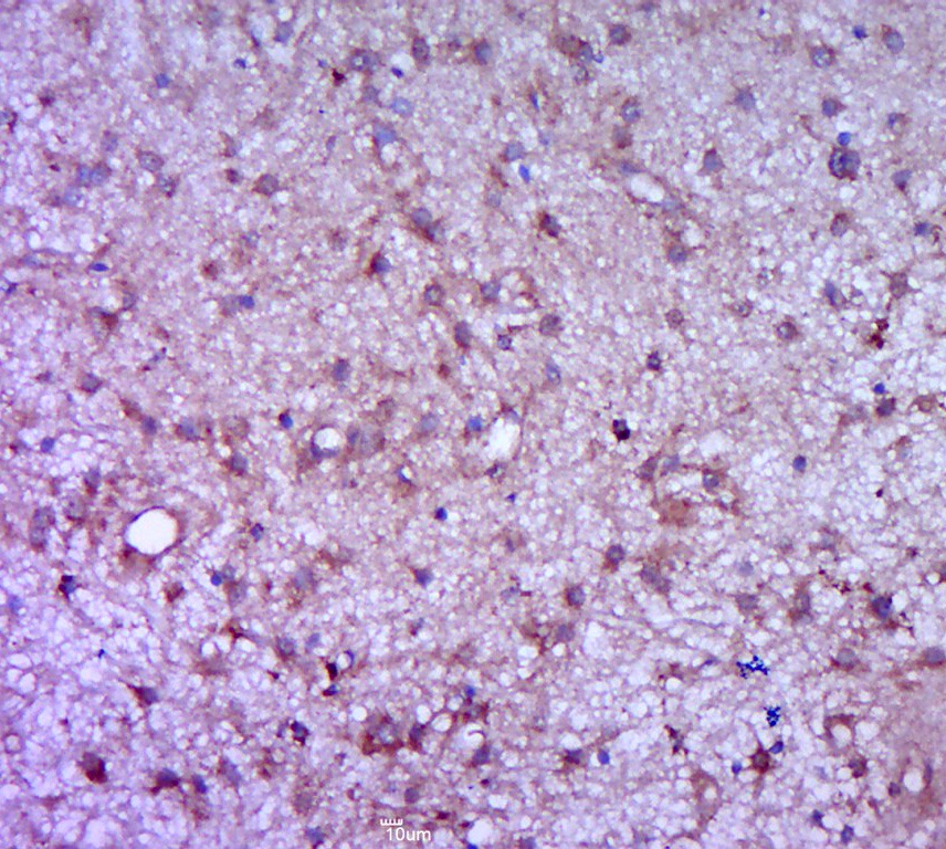 Anti-G-CSF Polyclonal Antibody