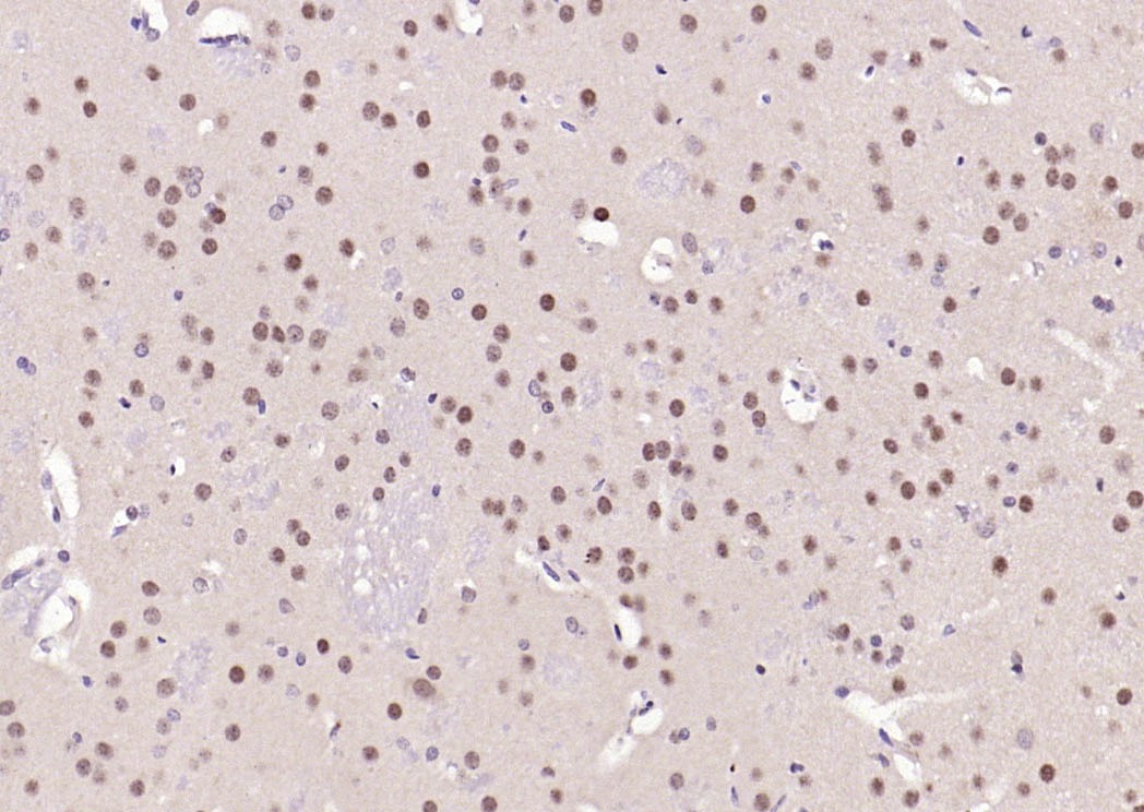 Anti-FOXO1A Polyclonal Antibody