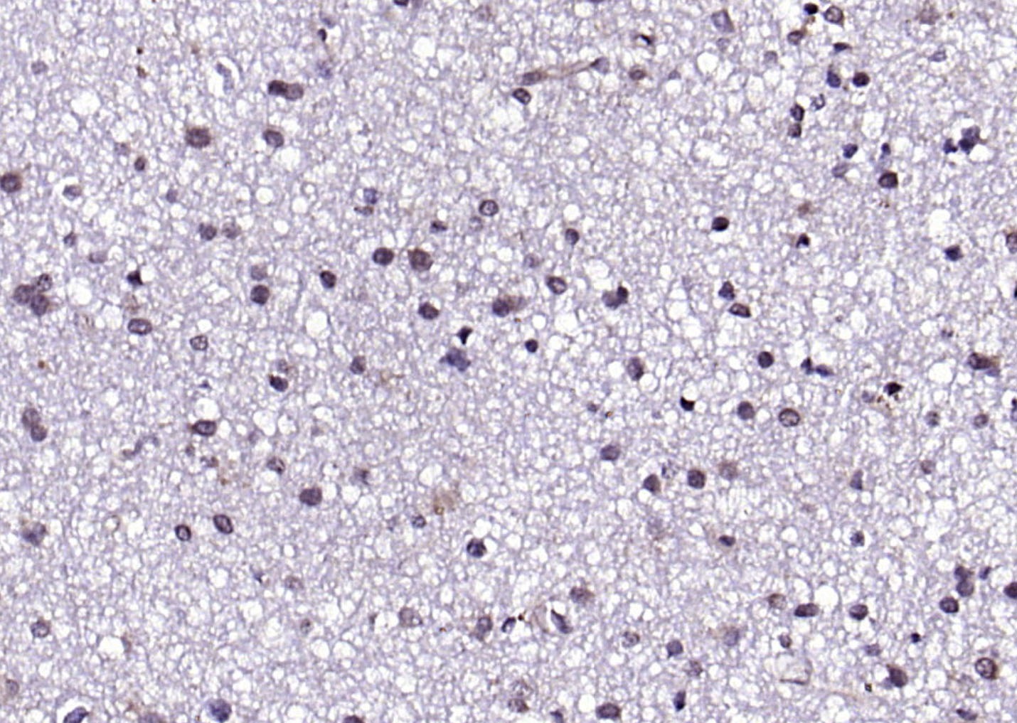 Anti-FGFR1 Polyclonal Antibody