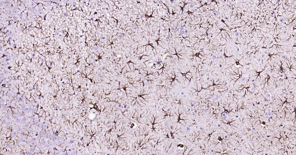 Anti-GFAP Antibody (3A643)