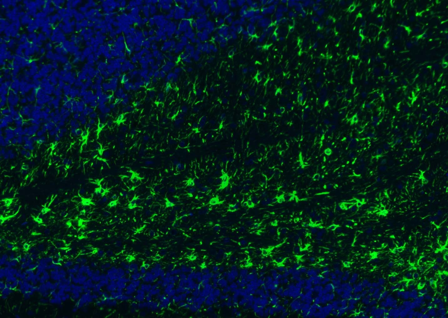 Anti-GFAP Polyclonal Antibody