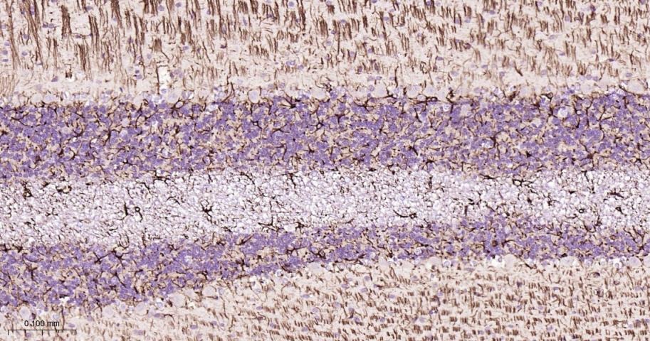 Anti-GFAP Polyclonal Antibody