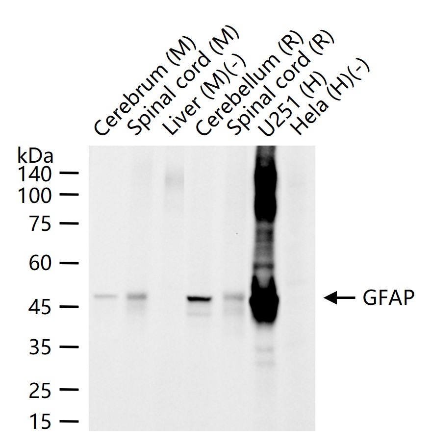 Anti-GFAP Antibody (3A643)