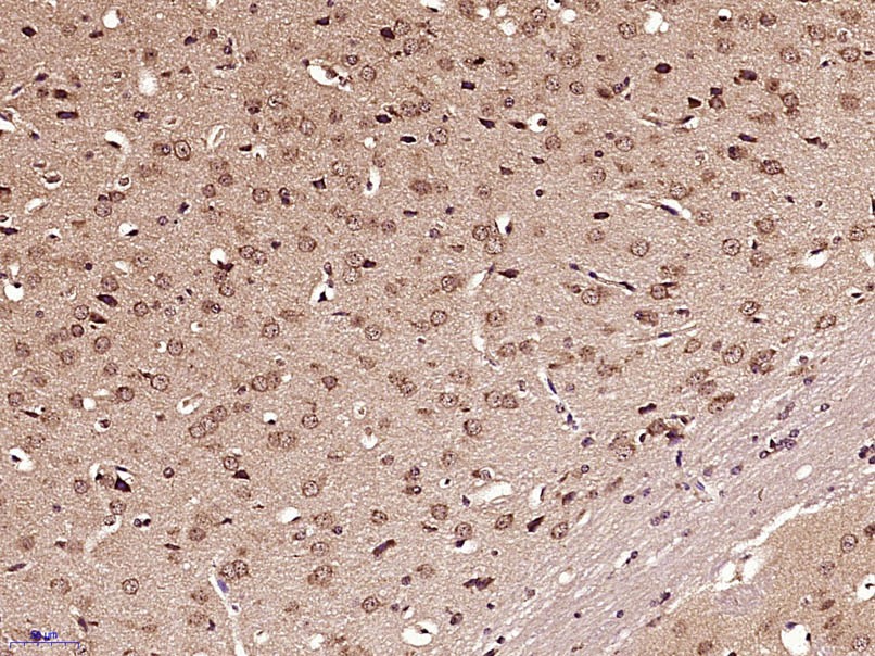 Anti-GLI1 Polyclonal Antibody