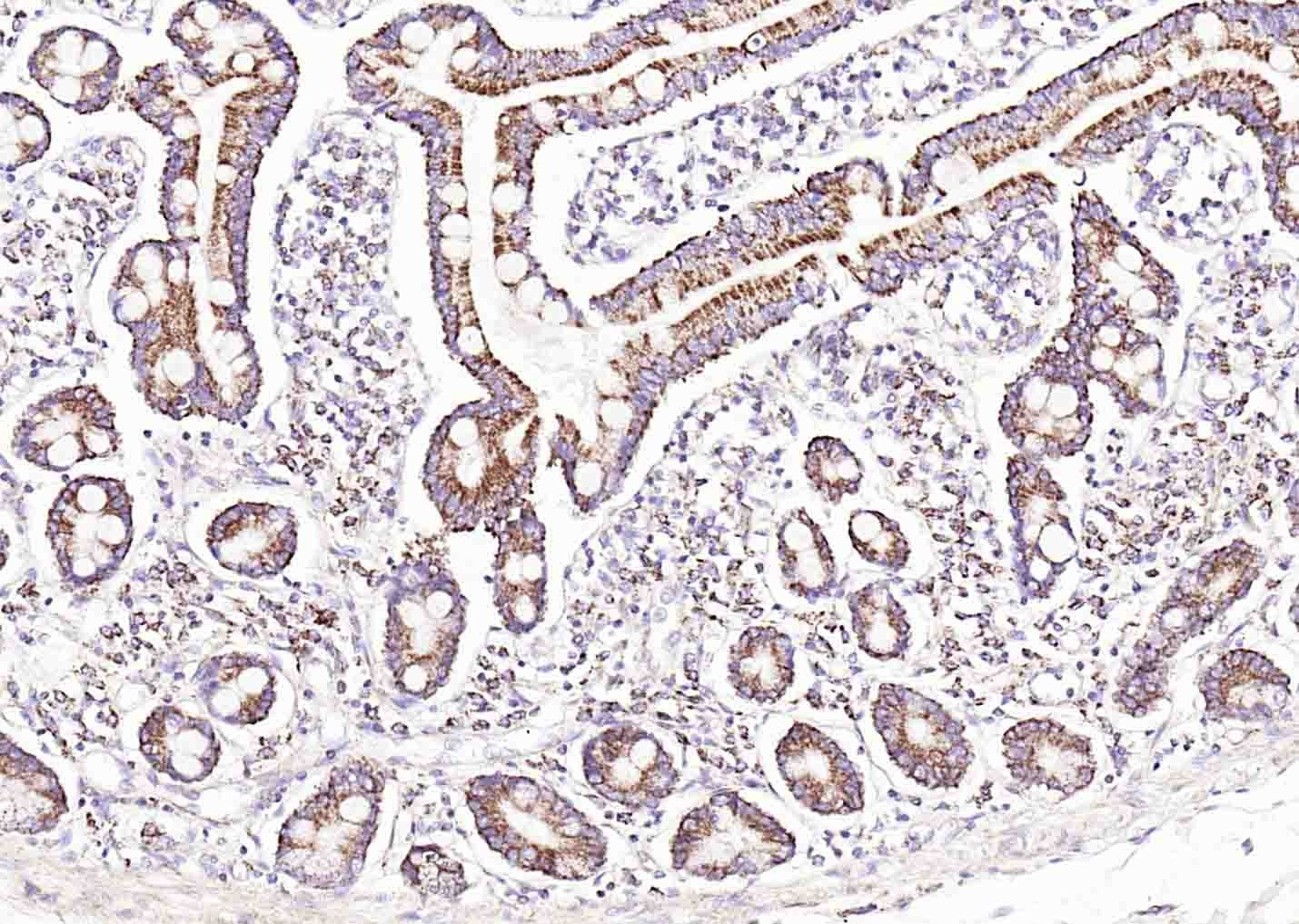 Anti-GFR Alpha-1/GFRA1 Polyclonal Antibody