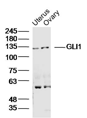 Anti-GLI1 Polyclonal Antibody