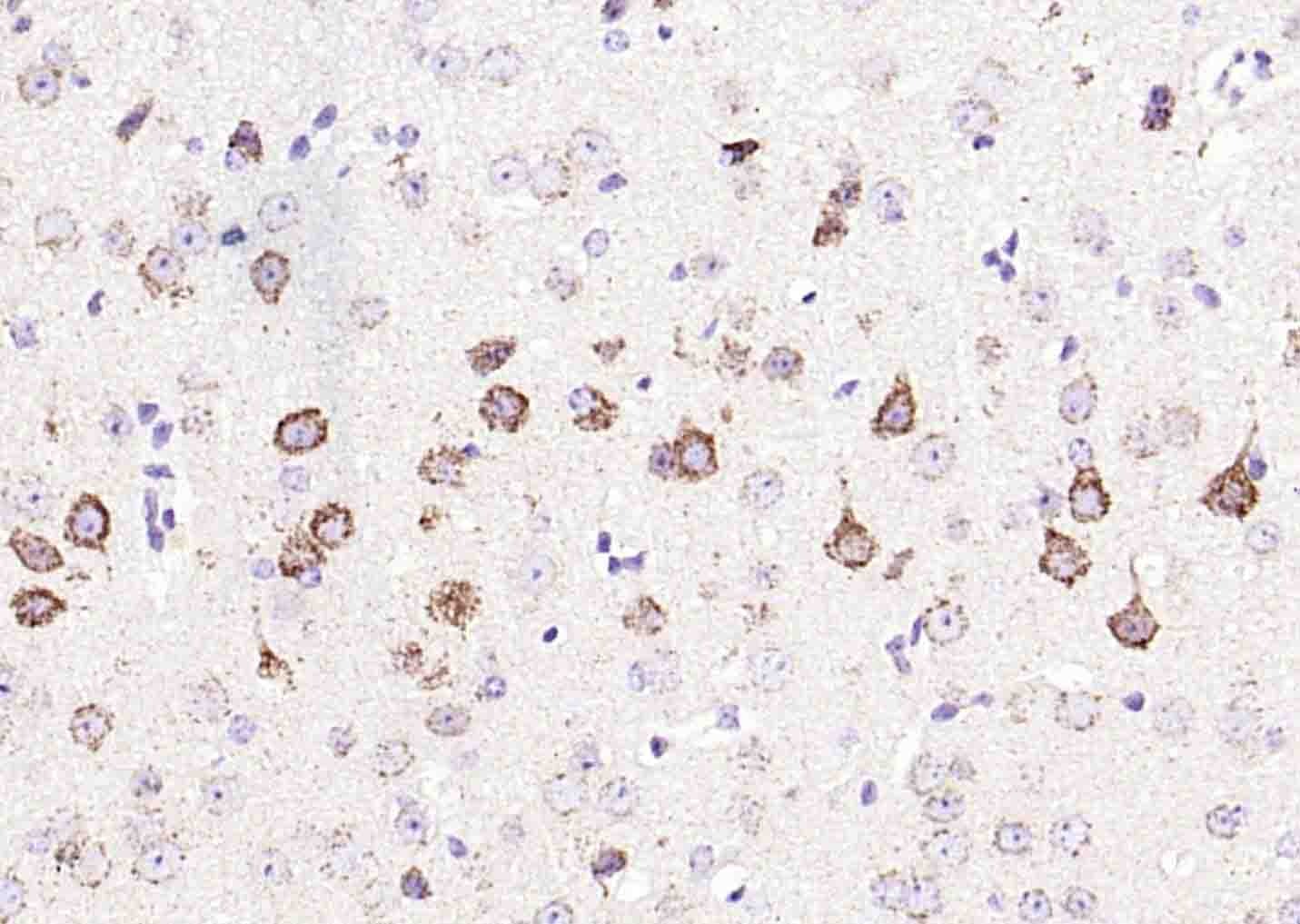 Anti-GFR Alpha-1/GFRA1 Polyclonal Antibody