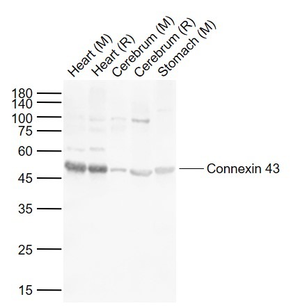 Anti-GJA1 Polyclonal Antibody 2