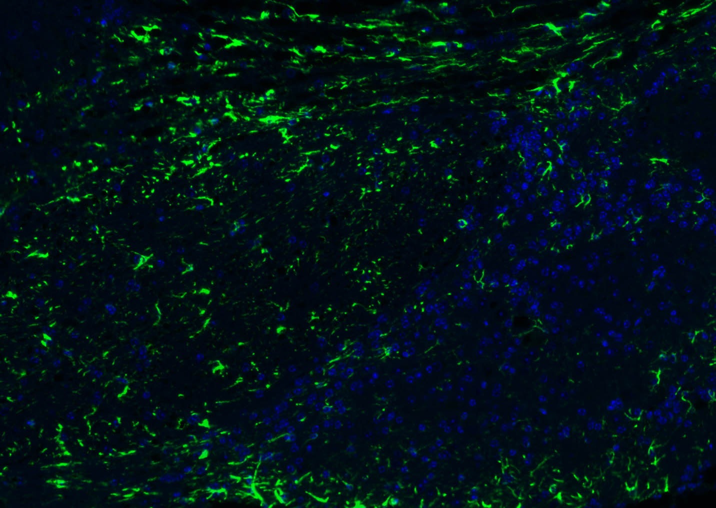 Anti-GFAP Polyclonal Antibody