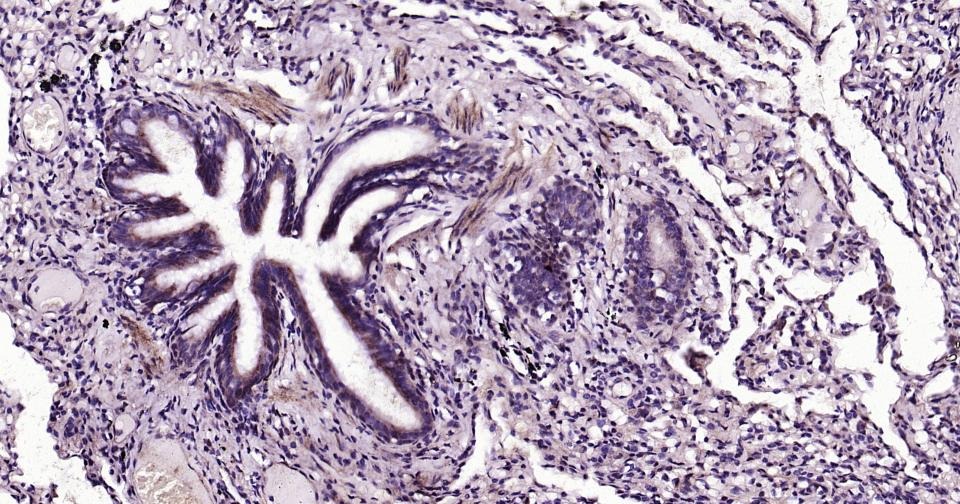 Anti-GJA5 Polyclonal Antibody