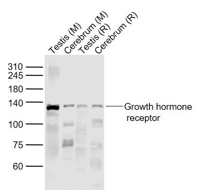 Anti-GHR/Growth Hormone R Polyclonal Antibody
