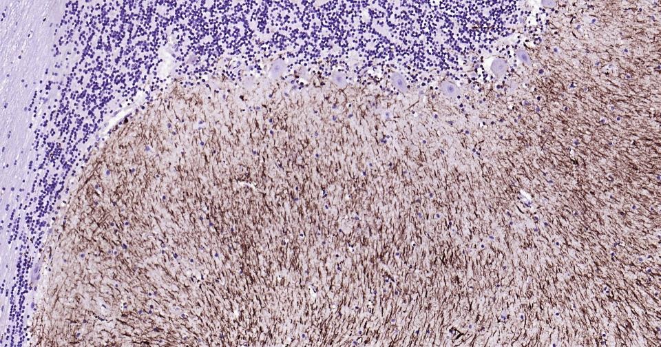 Anti-GFAP Antibody (3A643)